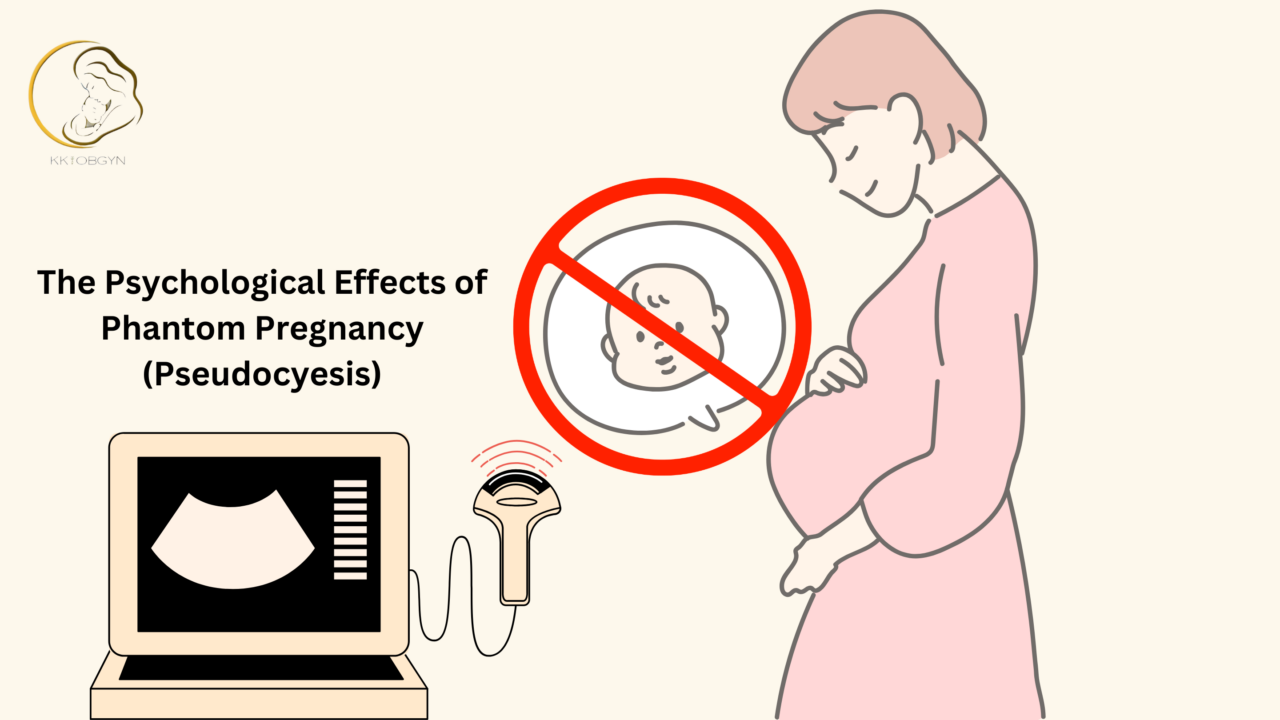 The Psychological Effects of Phantom Pregnancy (Pseudocyesis)