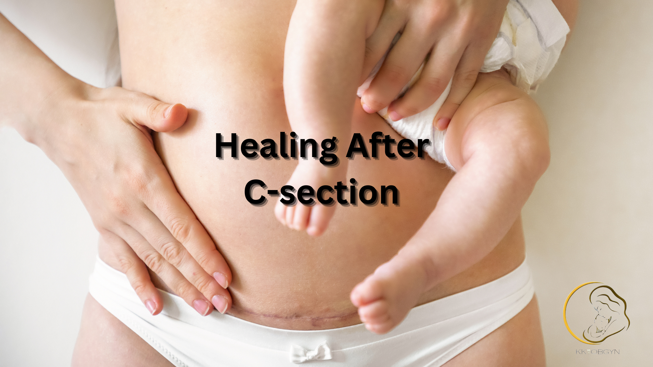 Healing After a C-Section: What to Expect and How to Recover